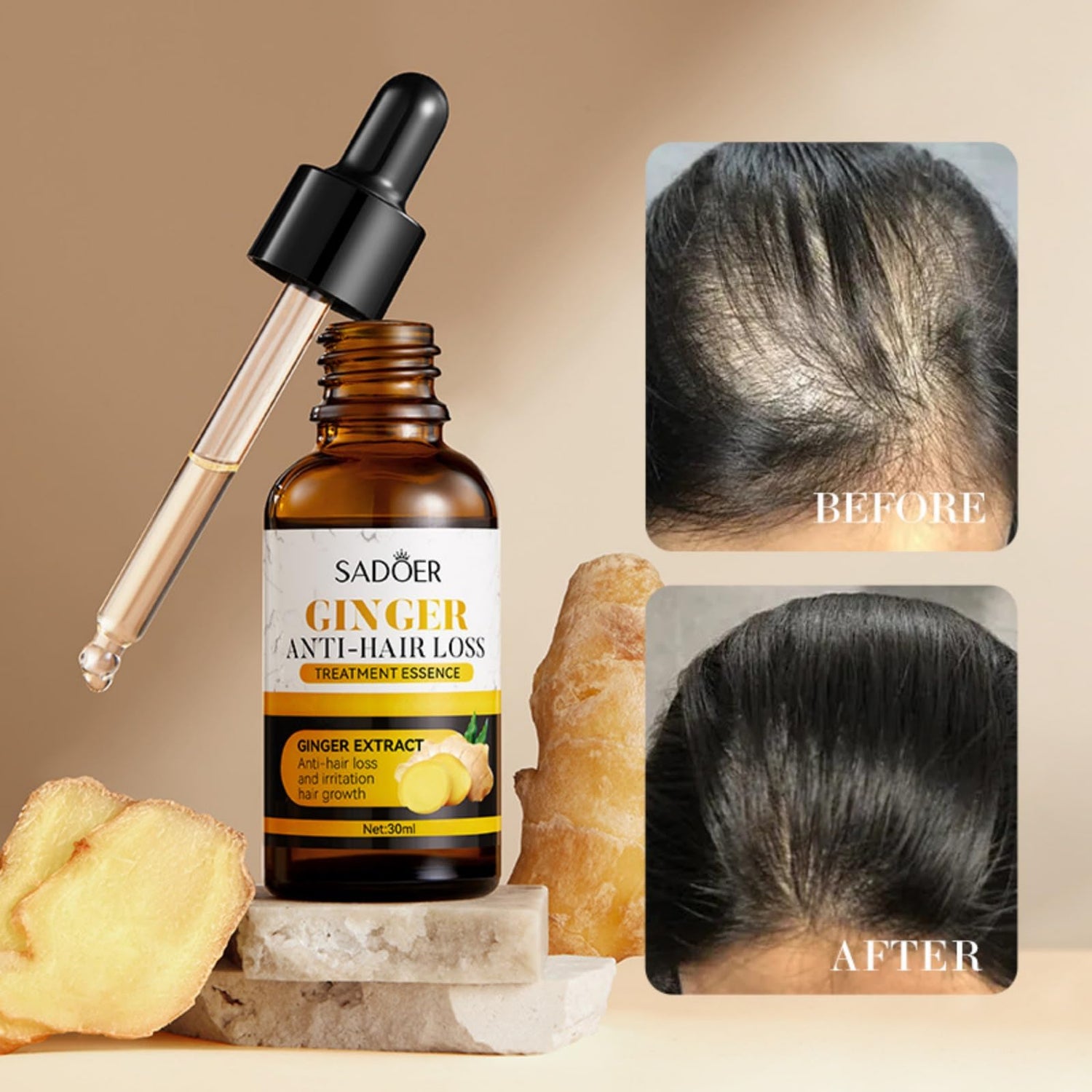 Ginger Scalp Nourishing Oil – Natural Botanical Hair Oil for All Textures